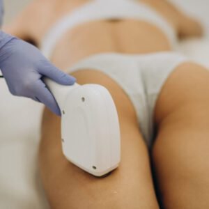 A Terapia com Laser é Eficaz no Tratamento de Estrias?