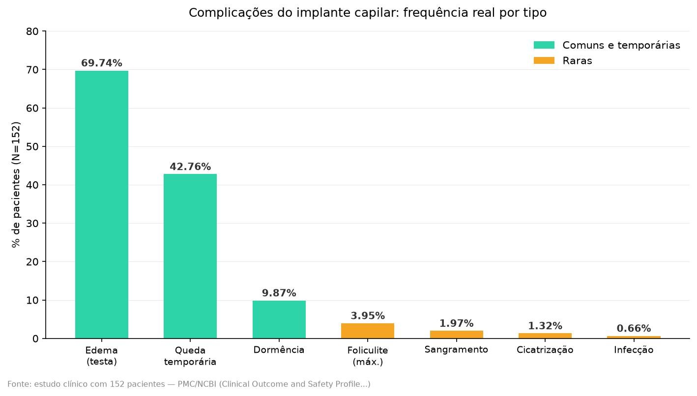 Gráfico com percentuais reais de complicações do implante capilar: edema, queda temporária, dormência, infecção, sangramento e cicatrização